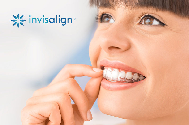 Invisalign in Manchester